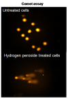 Hyperlink to picture of Comet Assay