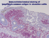 Hyperlink to immunochemistry assay.