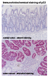Hyperlink to picture of p53 staining